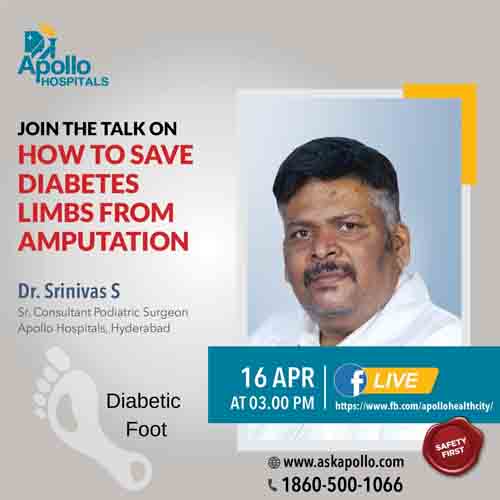 How To Save Diabetes Limbs From Amputation. Discuss your queries live with Dr. Srinivas S