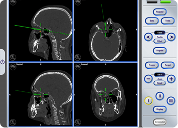 Oral & Maxillofacial Surgery