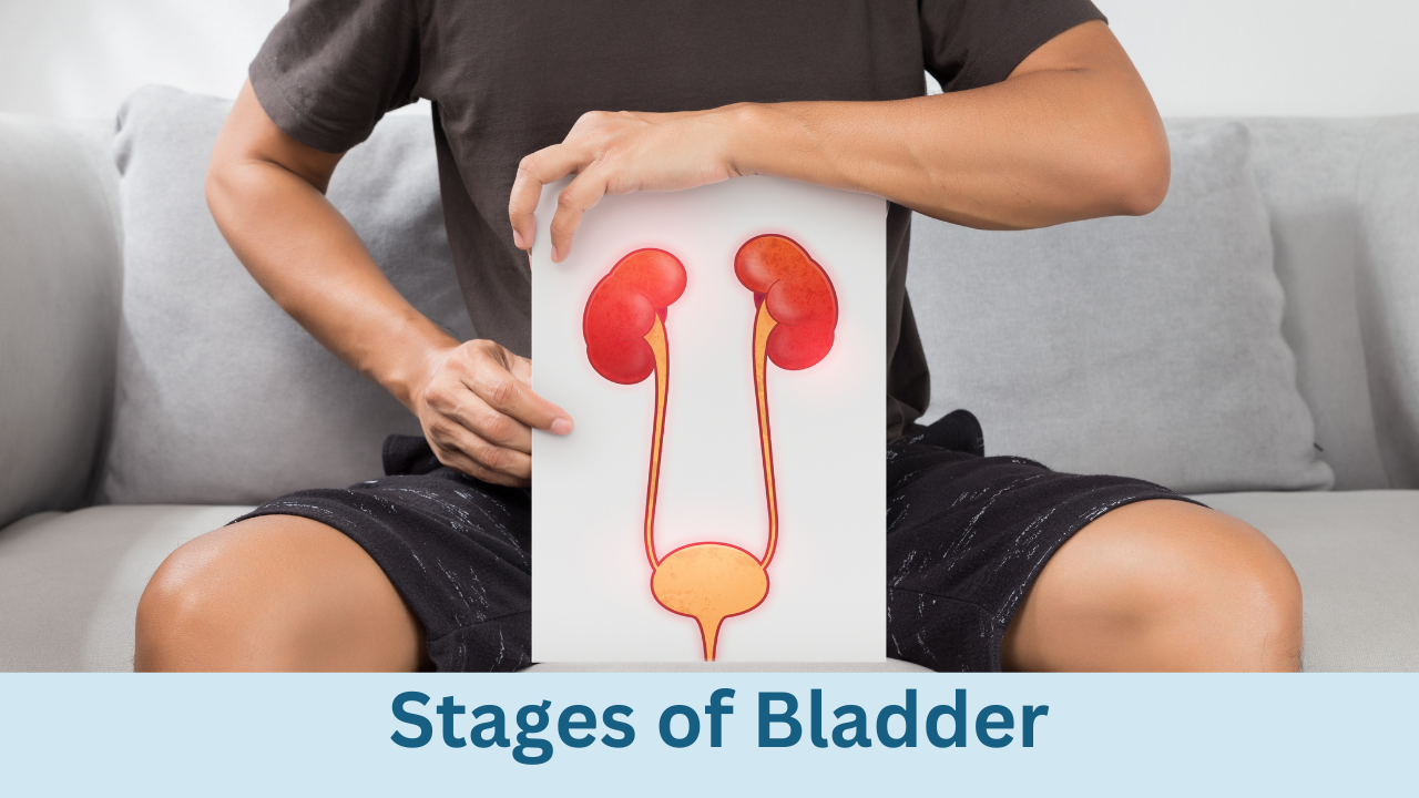 Bladder Cancer Stages: Understanding Disease Progression